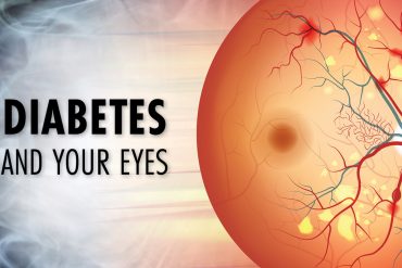 Types of Diabetic Eye Disease